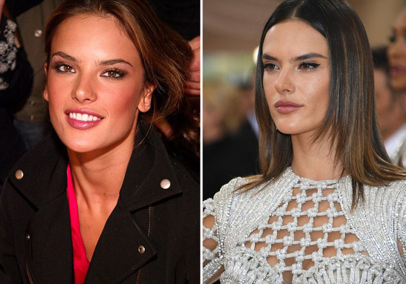 Antes-e-depois-da-sobrancelha-da-alessandra-ambrosio