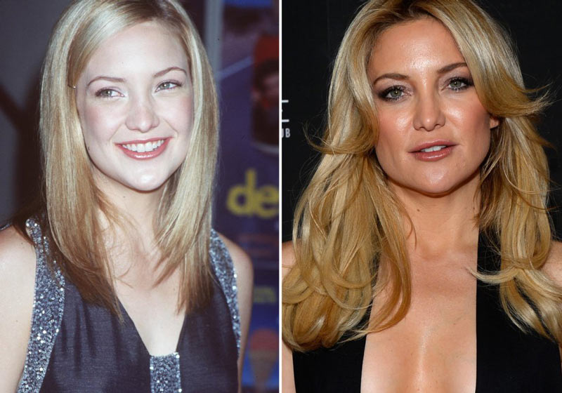 Antes-e-depois-da-sobrancelha-da-kate-hudson