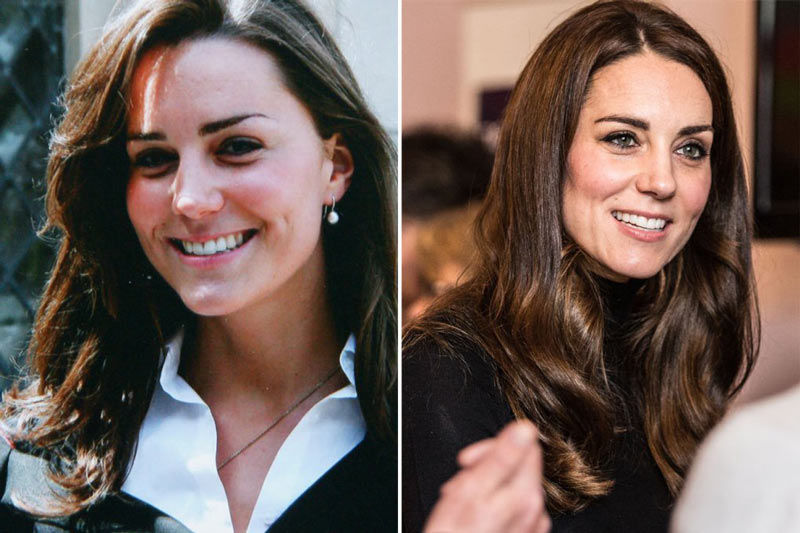 Antes-e-depois-da-sobrancelha-da-kate-middleton