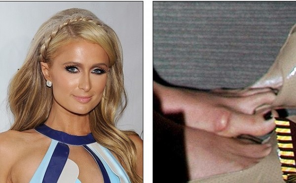 Paris Hilton pés feios