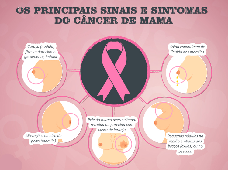 sinais-de-cancer-de-mama