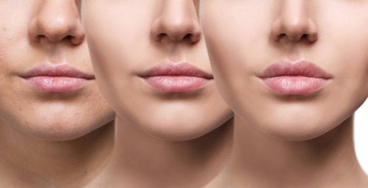 radiofrequencia-facial-beneficios