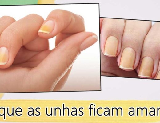 Unhas amarelas